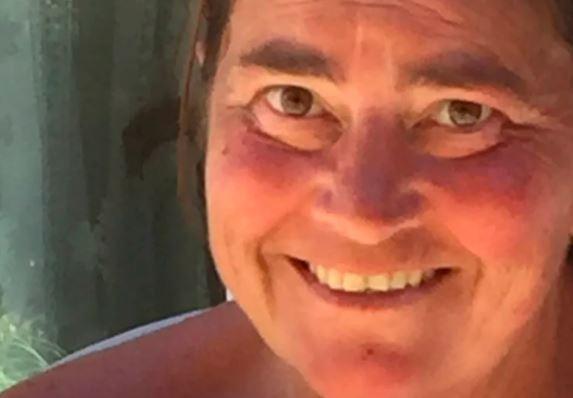 Doctors fail to diagnose mum who suffered a stroke